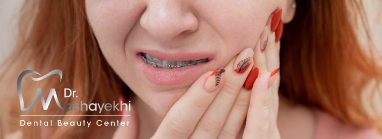 دندان قروچه چیست؟ (براکسیسم) + علل دندان قروچه و درمان آن