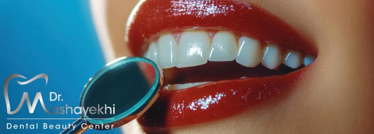 بررسی تخصصی تفاوت لمینت و کامپوزیت